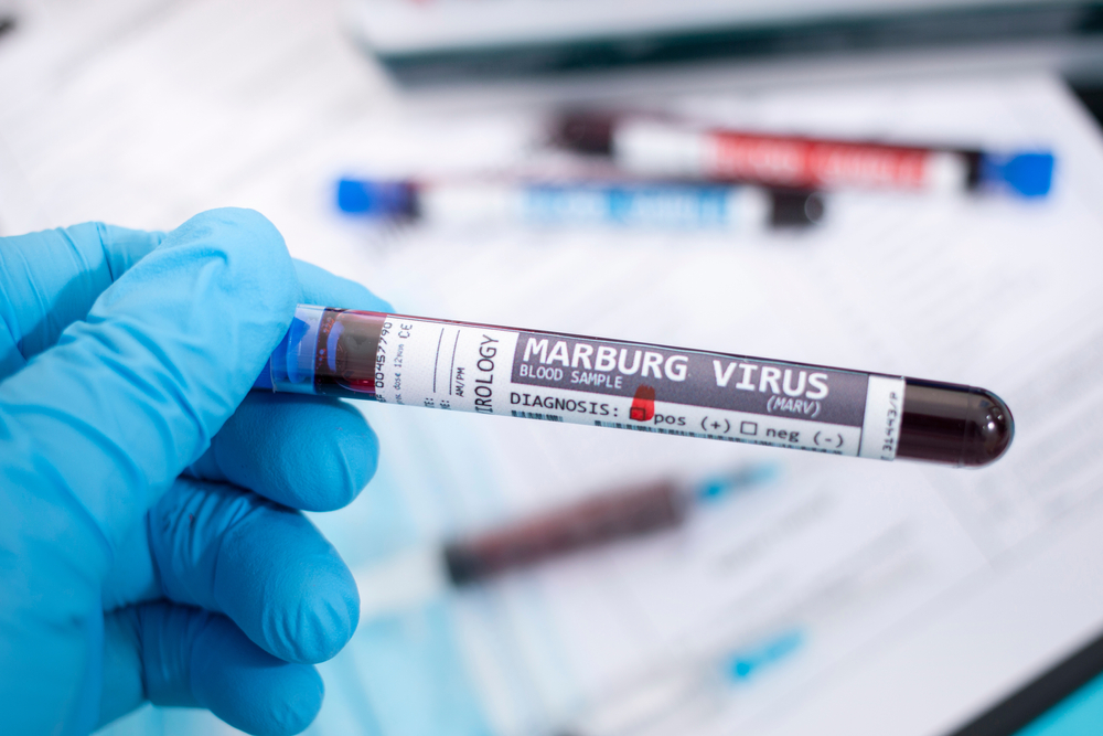 Tansaanias levib eluohtlik Marburgi viirus: mis haigusega täpsemalt tegemist? thumbnail
