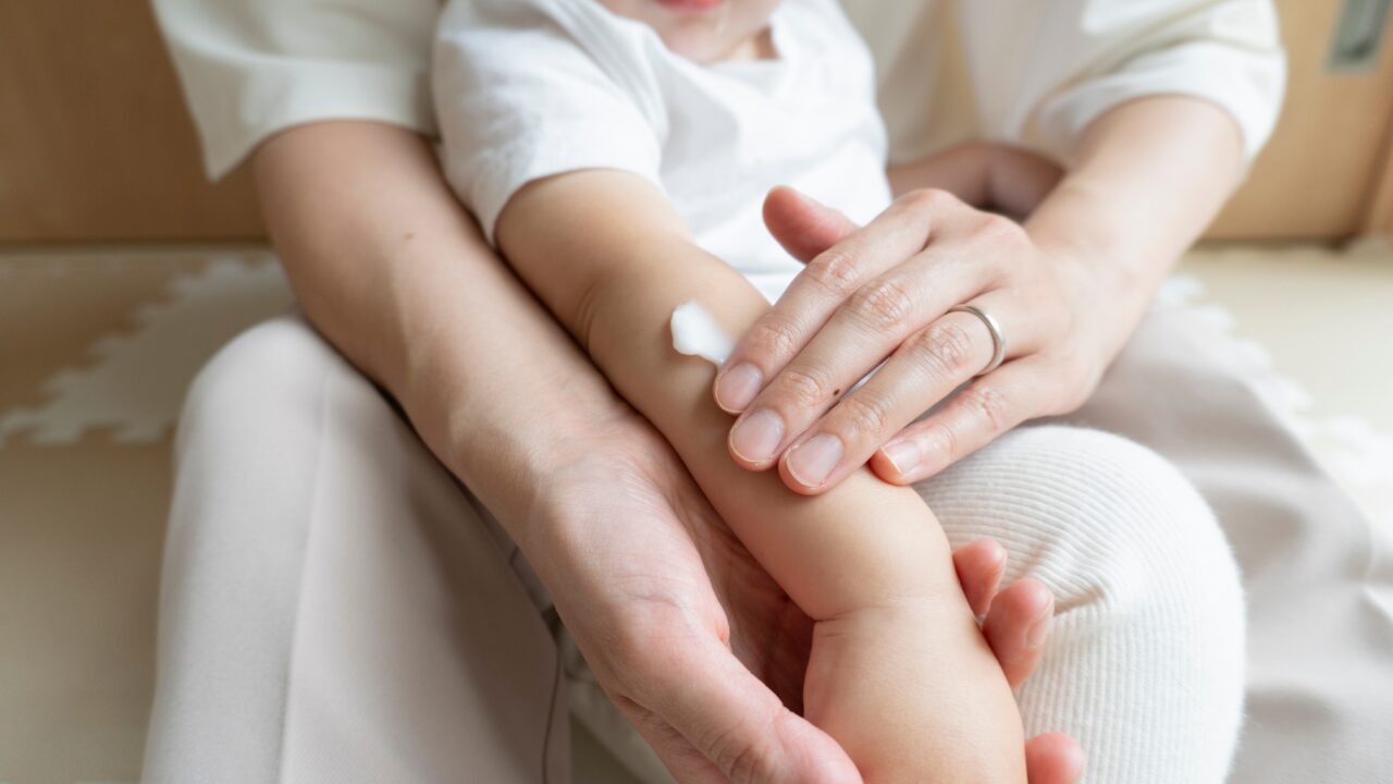 Nahaprobleemid beebidel ja väikelastel: mis aitaks neid leevendada? thumbnail